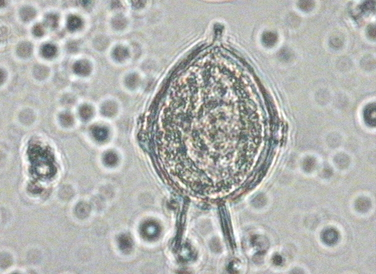 Dictyocha speculum